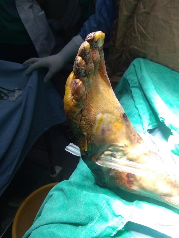 Varicose and more