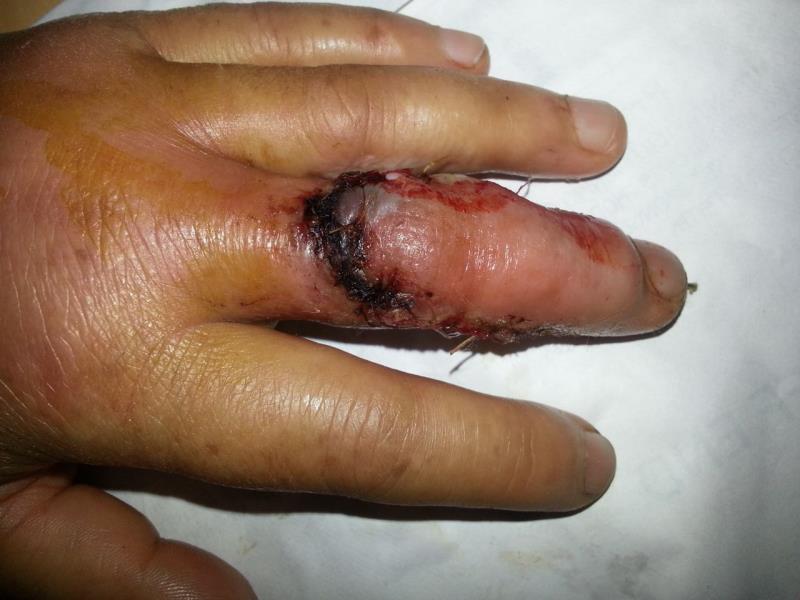 Varicose and more