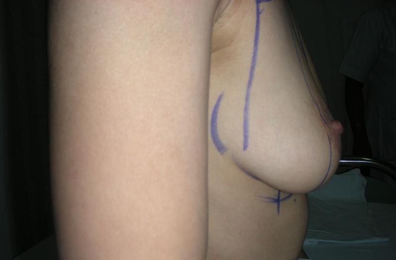 Varicose and more