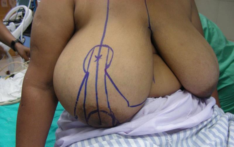Varicose and more