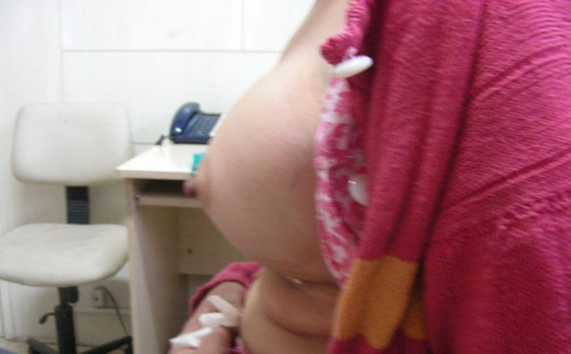 Varicose and more